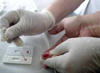 Piauí teve quase 3 mil casos de Aids nos últimos cinco anos, revela Sesapi